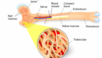 Bone Marrow transplant