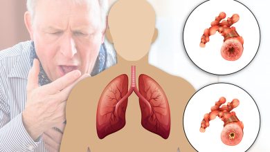 COPD