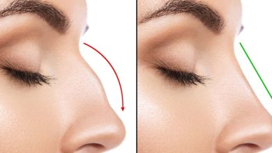 rhinoplasty cost in Haryana