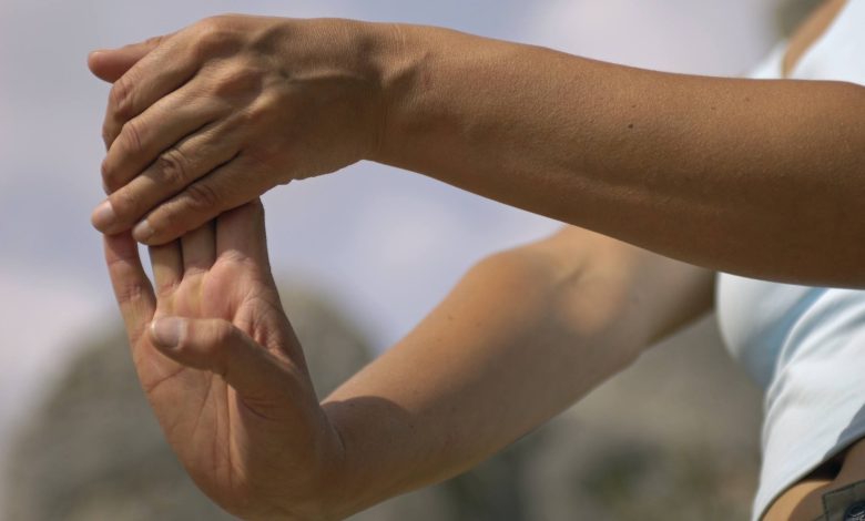 Dupuytren's Contracture