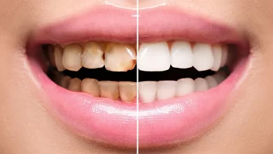 dental