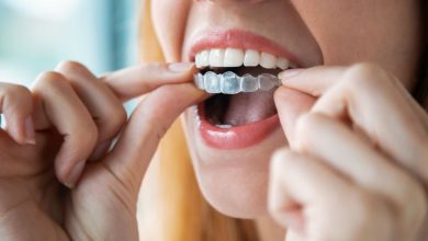 Importance Of Retainers After Invisalign And Braces