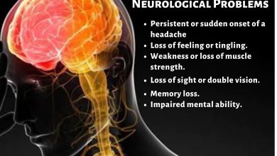 Signs of Neurological Problems And How To Identify Them By Ruhan Nasany Signs of Neurological Problems And How To Identify Them By Ruhan Nasany Sachin Dogra, Today at 23:23